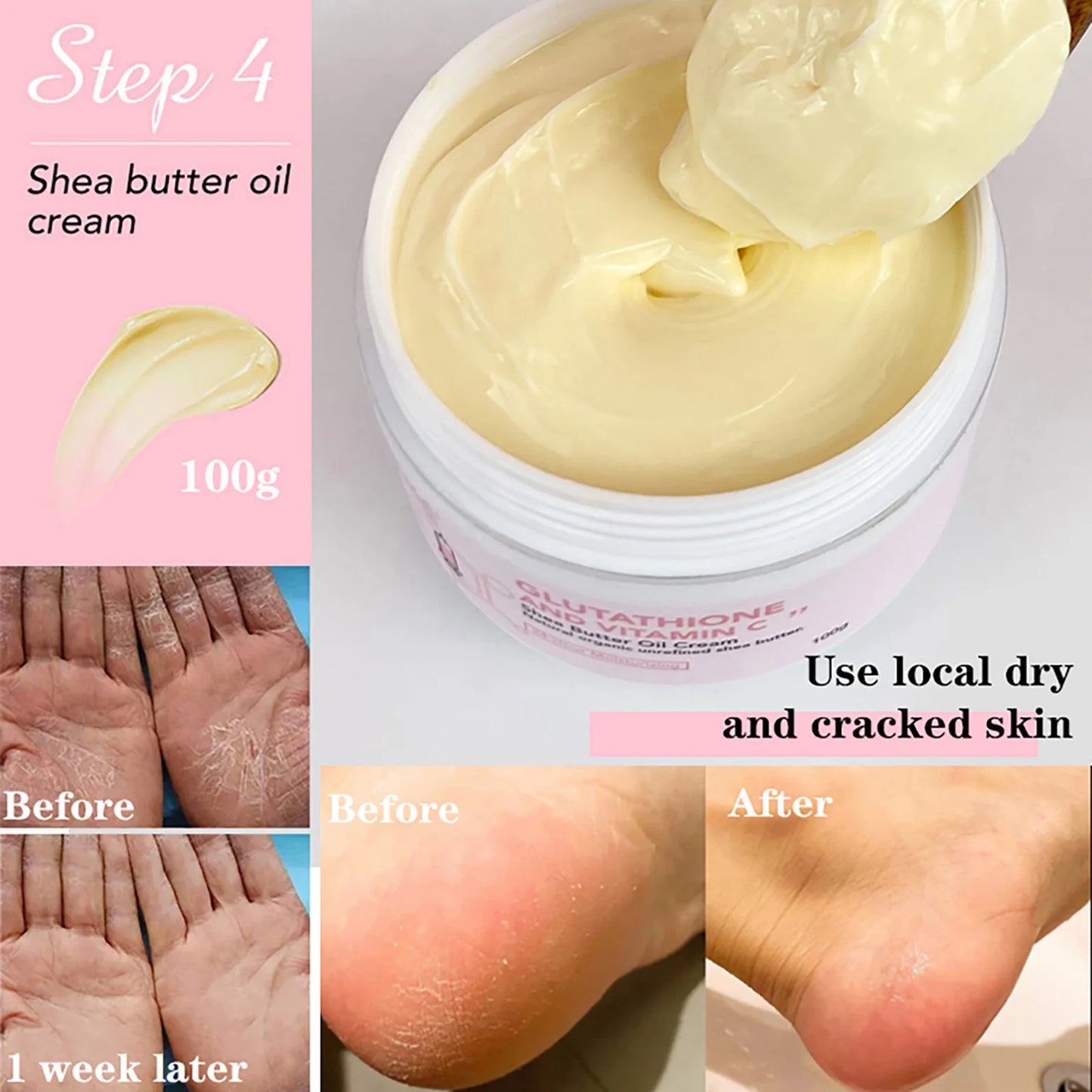 Ailke Glutathione Vitamin Shea Butter Cream, Brightening