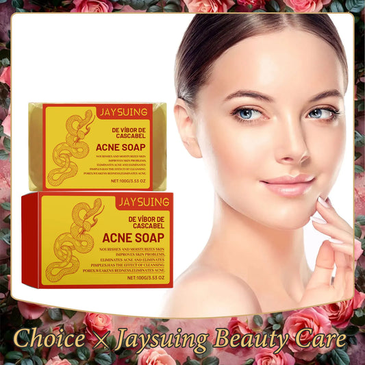 Acne Treatment Soap Pimple Remove Pigment Deep Cleansing